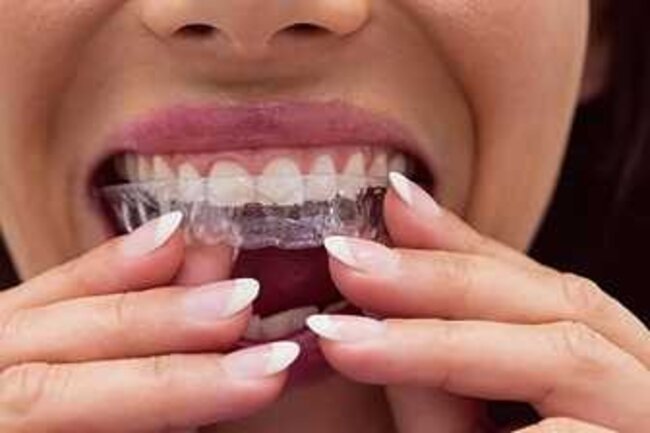 Streamlining Cosmetic Dentistry