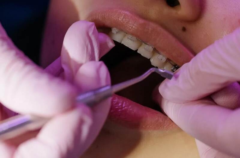 4 Reasons Why You Need To Visit An Orthodontist Orthodontist